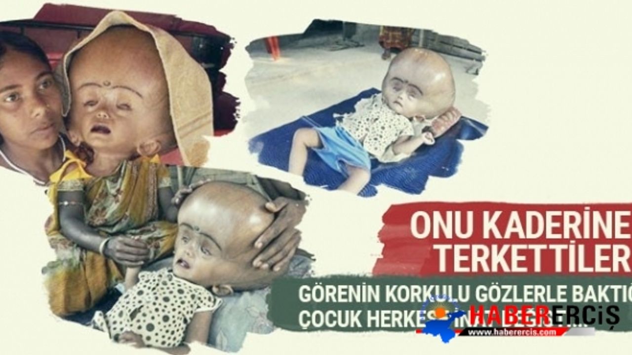Herkes onu korkusundan kaderine terk etti ama öyle değişti ki...