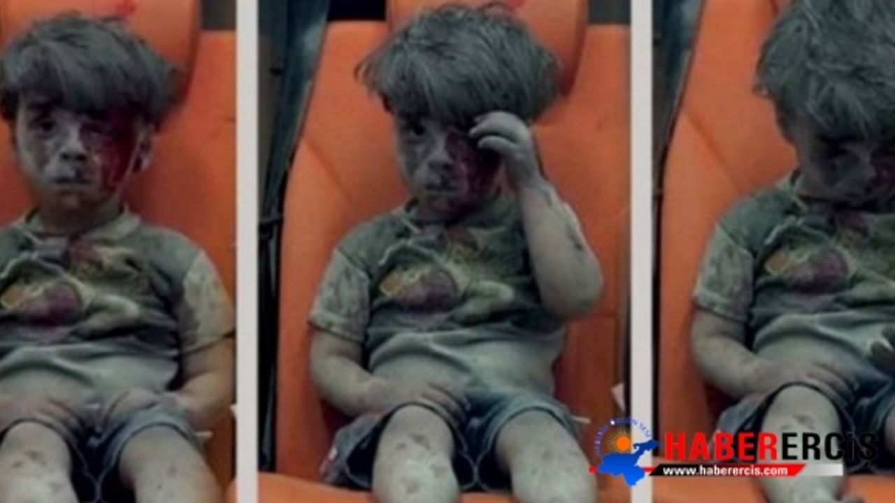 Suriye Savaşı'nın simgesi Ümran bebeğin son hali...