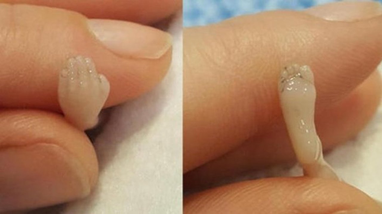 14 haftalık doğan bebeğinin fotoğraflarını paylaştı