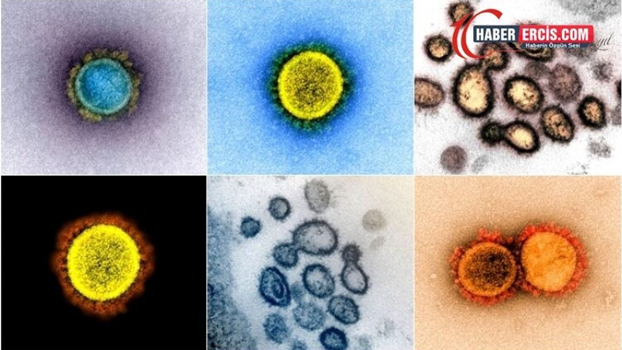 Yeni tip koronavirüsün insan hücrelerindeki yayılışı elektron mikroskobuyla görüntülendi