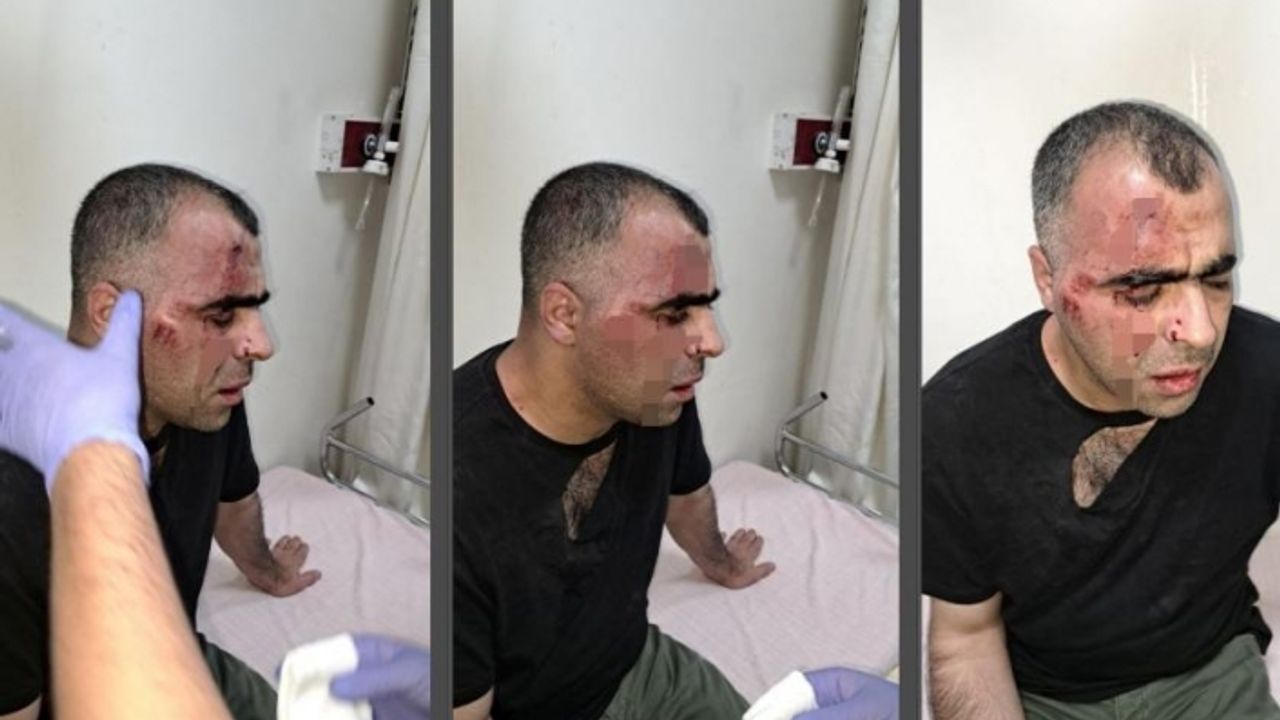 Gazeteci Sinan Aygül’e saldıran AKP’li belediye başkanının korumaları tahliye edildi