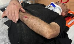 Van’ın Erciş İlçesinde Bir Kişi Sopalı Saldırıya Uğradı