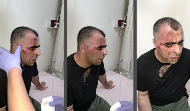Gazeteci Sinan Aygül’e saldıran AKP’li belediye başkanının korumaları tahliye edildi