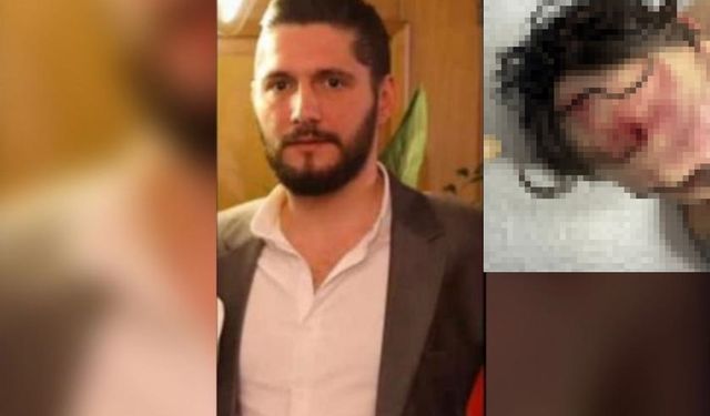 Gözaltında hayatını kaybeden Kahyoğlu’nun avukatı: Kafatasında silah kabzası izi vardı