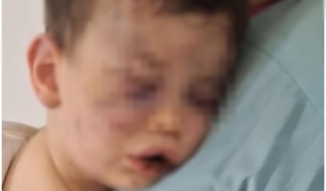 Bebeğe şiddet uygulayan erkek tutuklandı