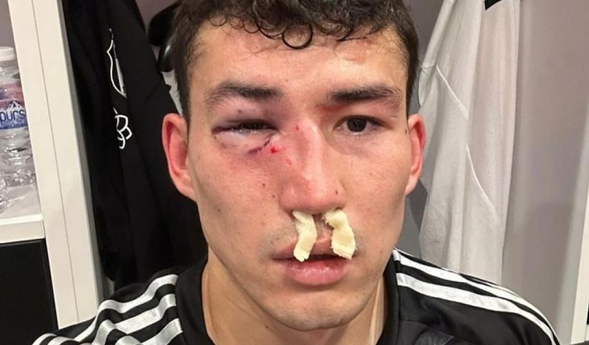 Beşiktaş: "Zaynutdinov’un burnunda ve göz çukurunda kırık saptanmıştır"