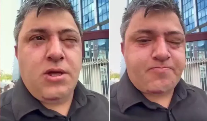 Altındağ Belediye Başkanı Tiryaki hakkında darp iddiası: "Toplantı odasında 6 kişiyle saldırıya uğradım"