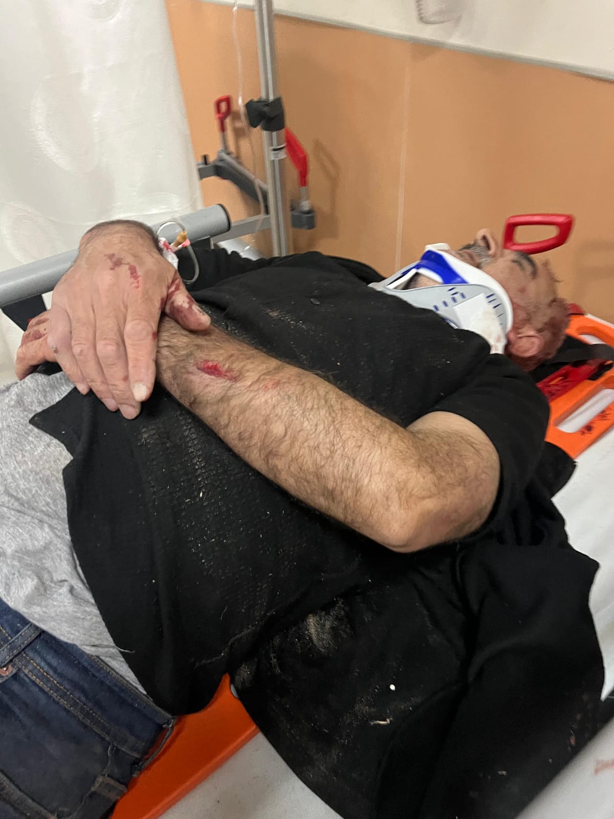 Van’ın Erciş İlçesinde Bir Kişi Sopalı Saldırıya Uğradı
